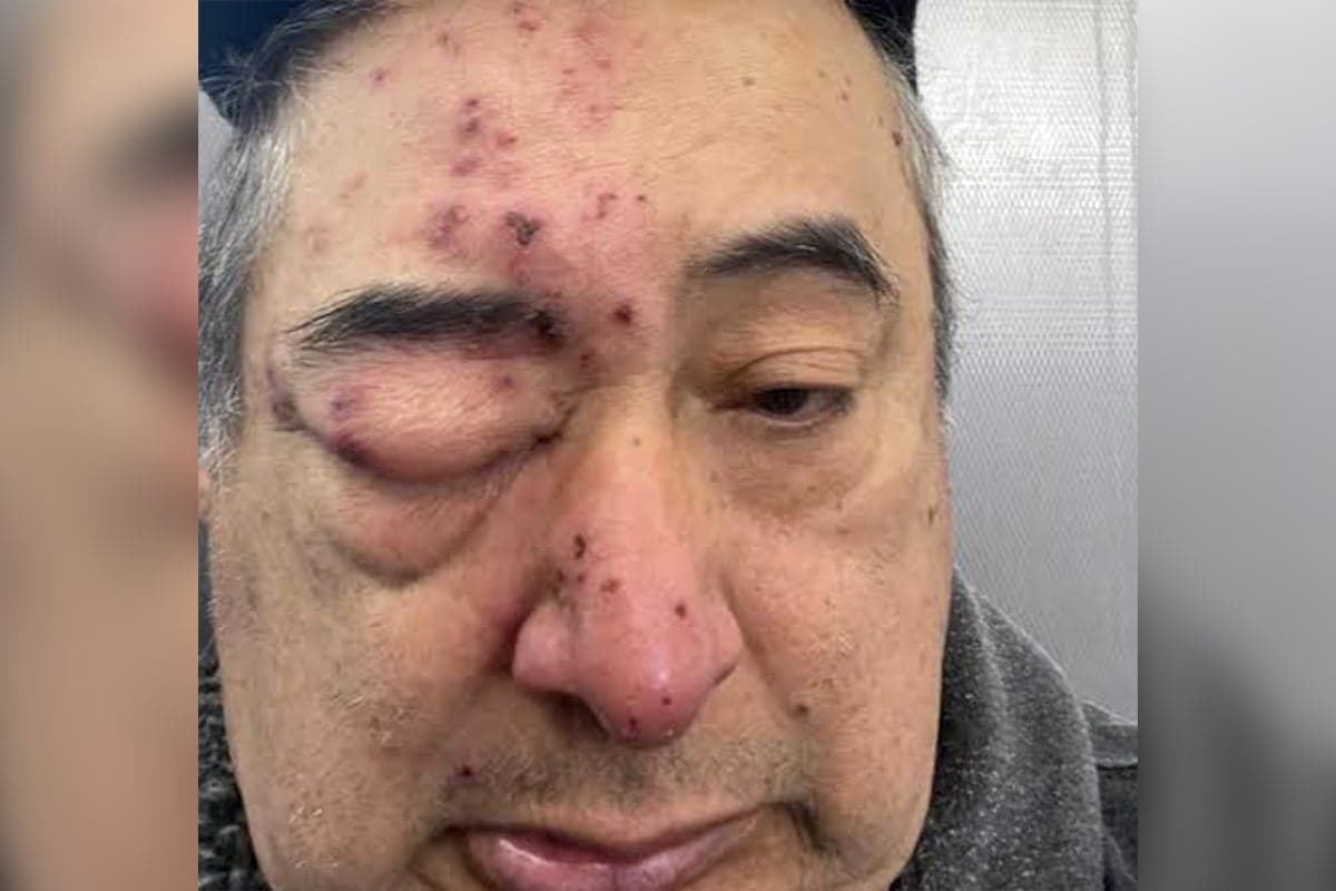 Chicago man woke up in his home with rat ‘chewing on his face’ after complaining about infestation