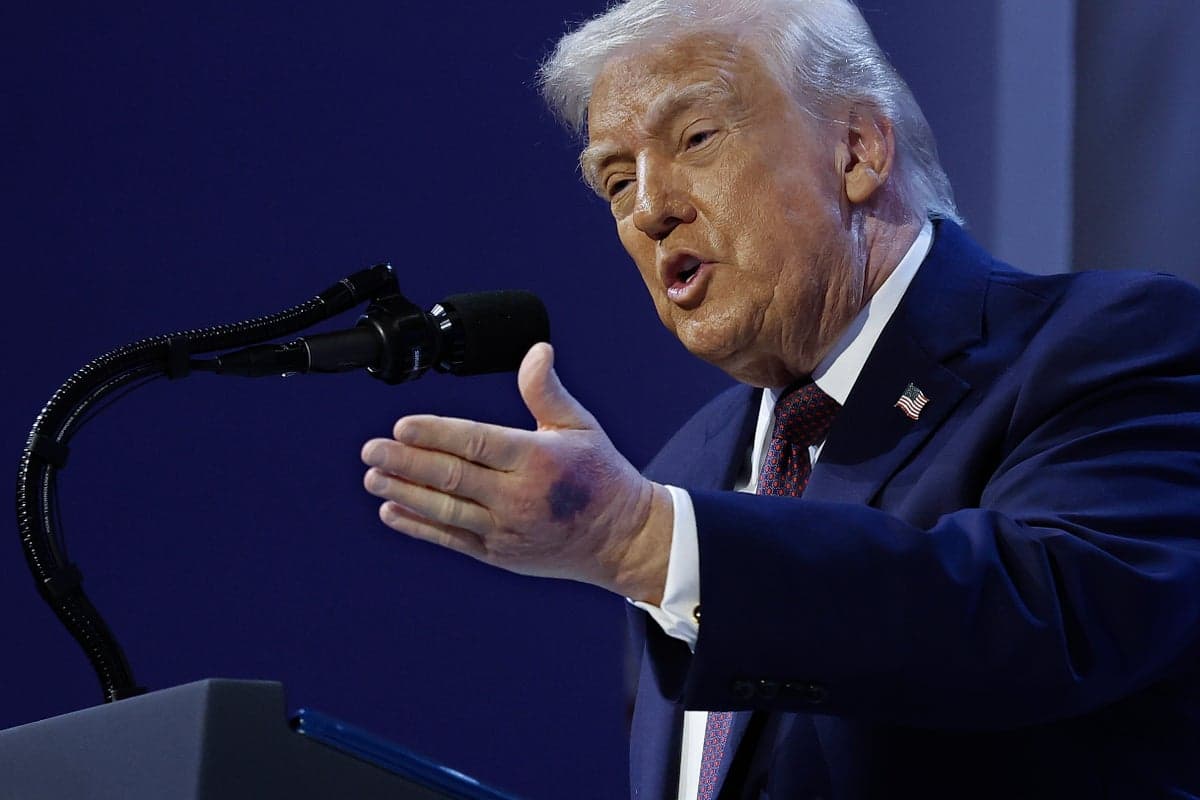 Dick Cheney’s doc says Americans ‘deserve answers’ about the mysterious ailments impacting Trump