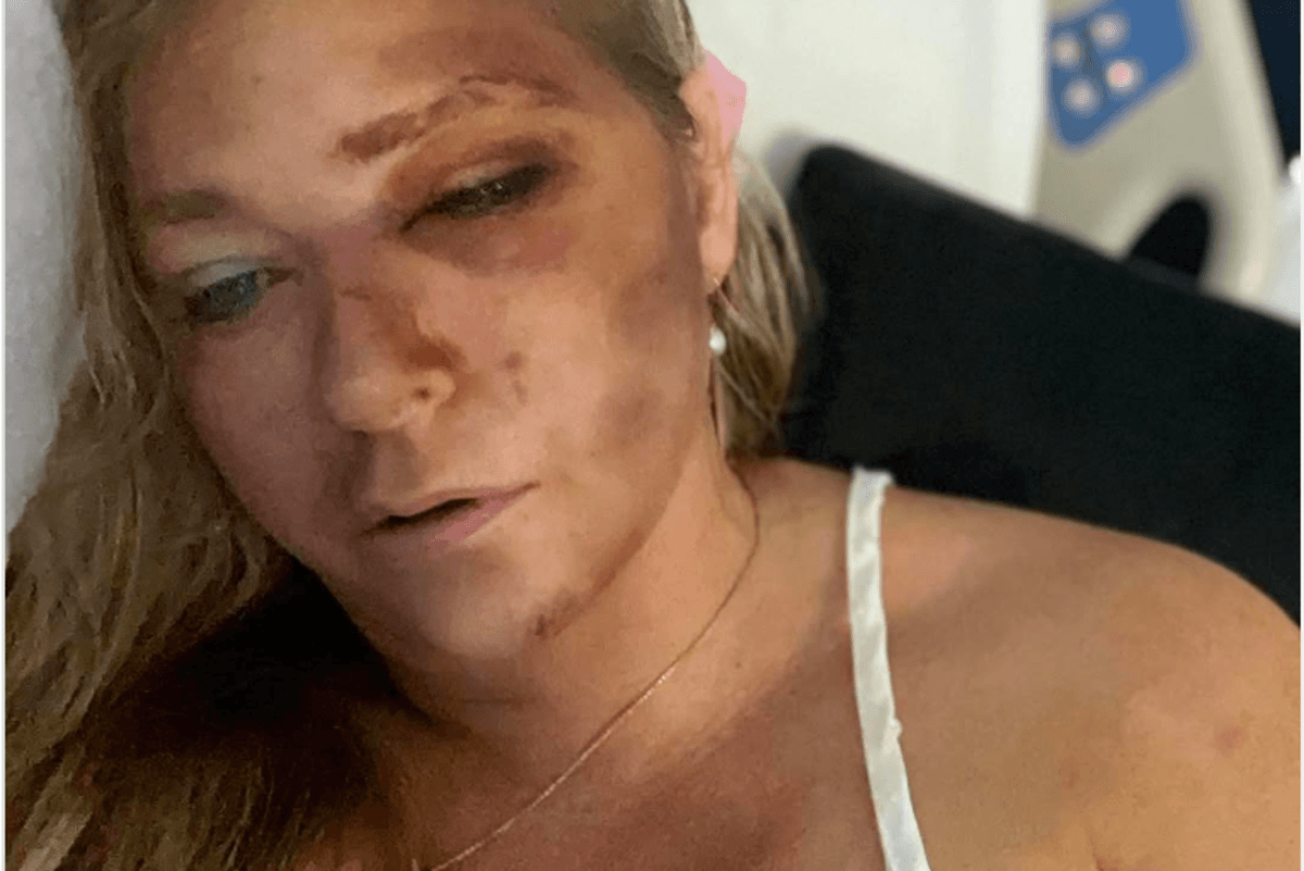 Virginia Giuffre, who claimed abuse by Prince Andrew and Jeffrey Epstein, says she has days to live after car wreck