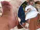 Britney Spears cries as she updates fans on her swollen ankle... as its revealed she injured herself by doing cartwheels: 'My feet are so ugly'