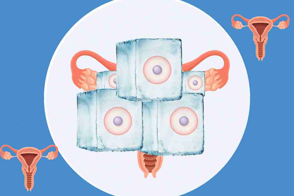 ‘You can feel very alone’: What’s it really like to freeze your eggs?